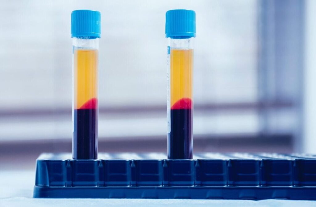 prp3